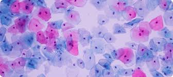 pap smear